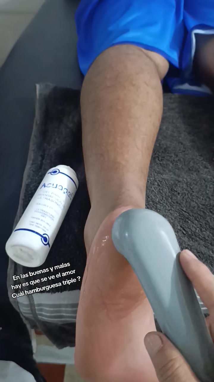@NacsonPieGrande