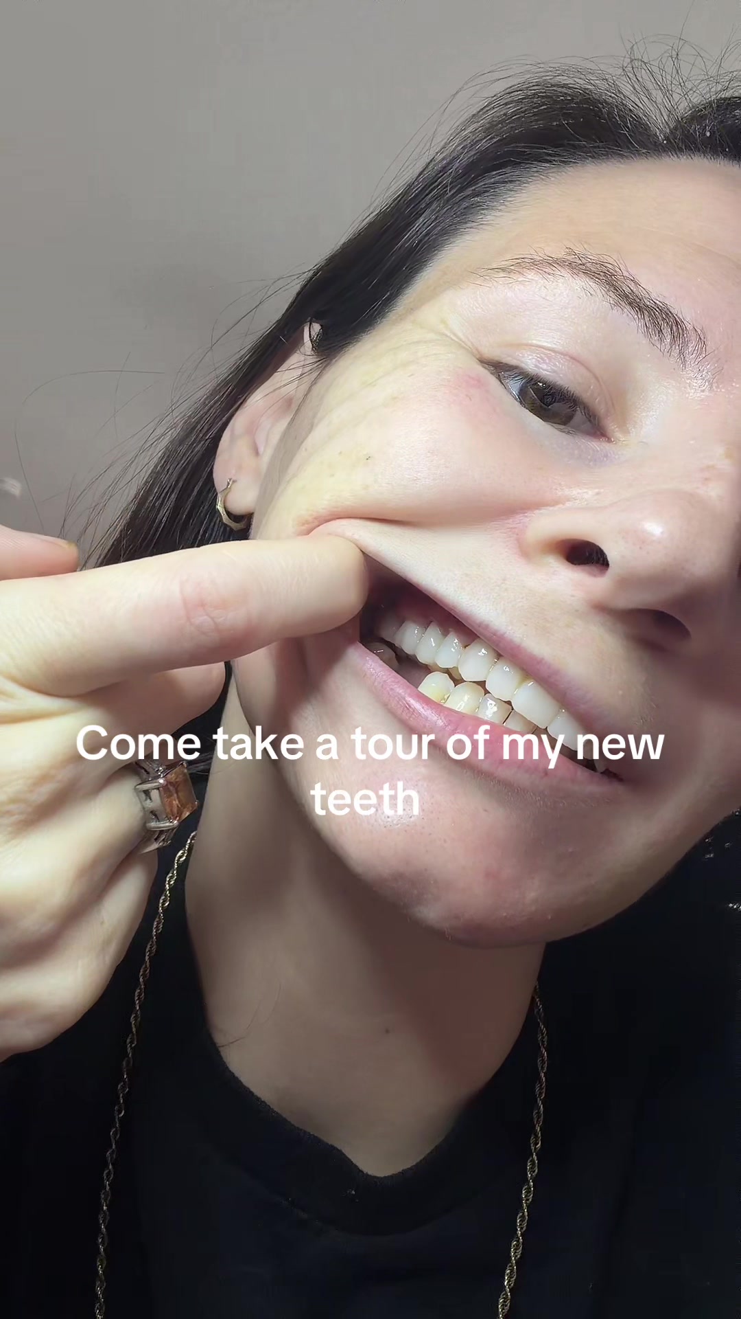 @Taylor Toothtales 🦷