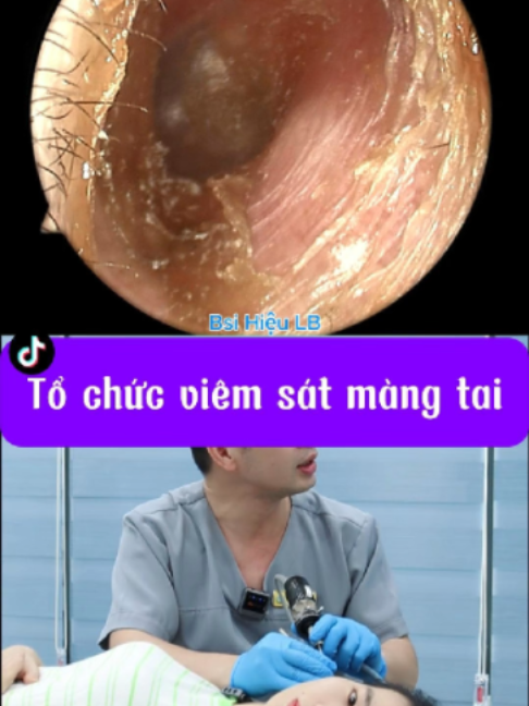 @Bs Hiệu Tai Mũi Họng Long Biên