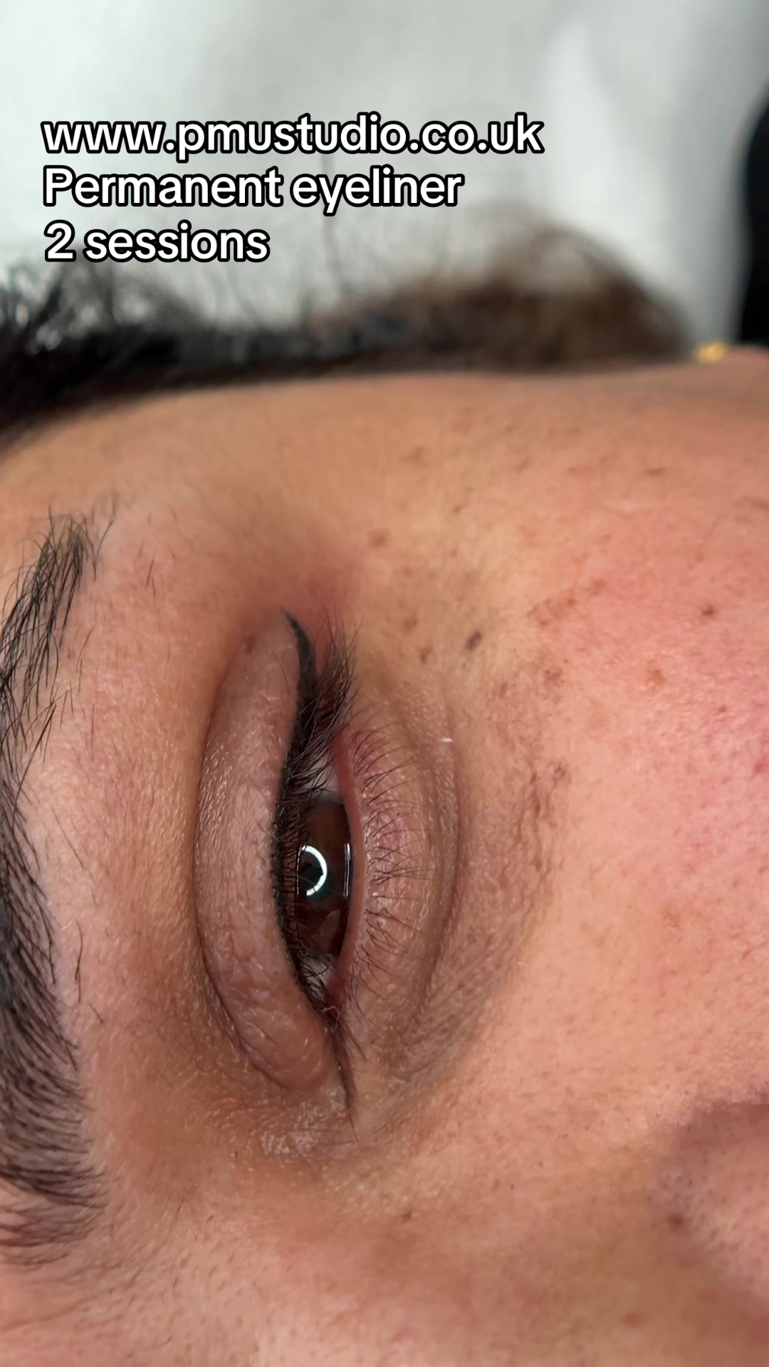 @Permanent Makeup & Removal
