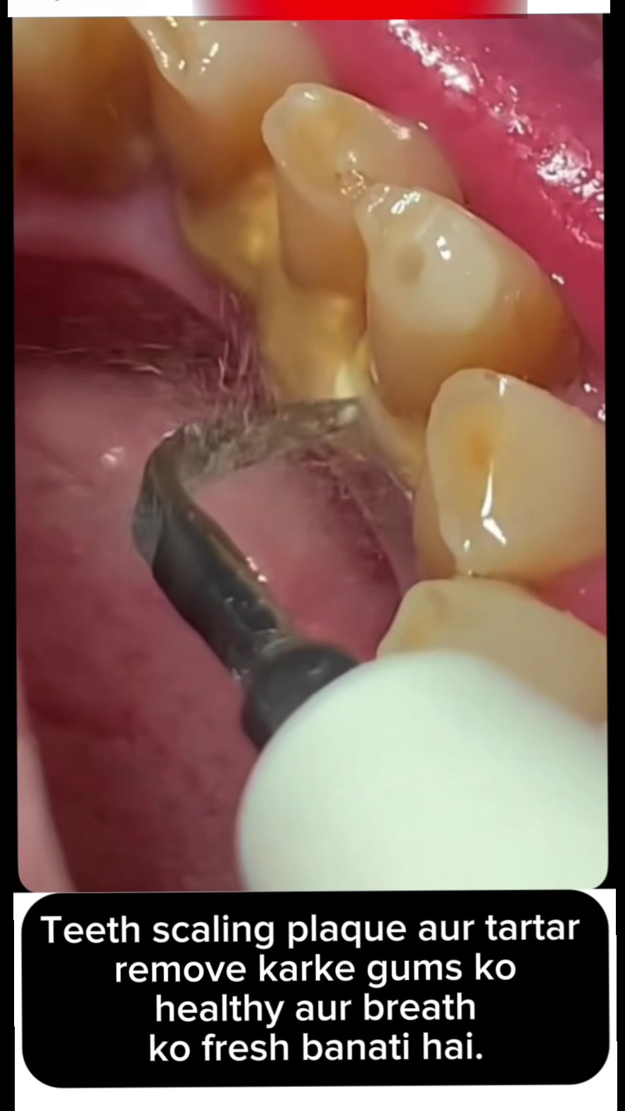 @Aᴇsᴛʜᴇᴛɪᴄs & Dᴇɴᴛᴀʟ Wᴏʀᴋ's🦷