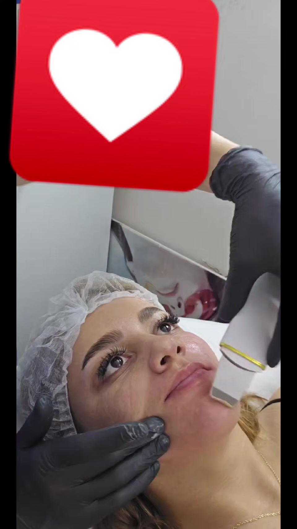 @ehmedli_kosmetoloq_lazeroloq