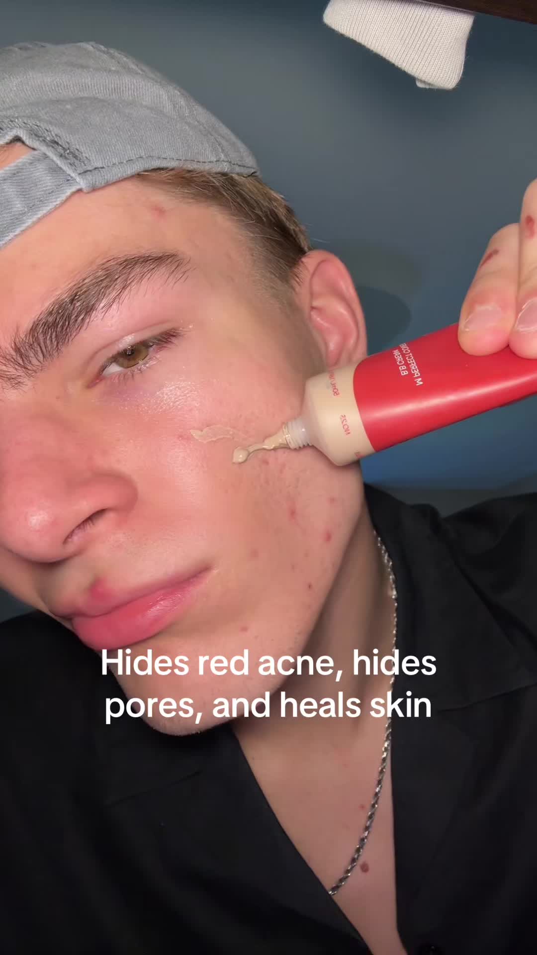 @Finn