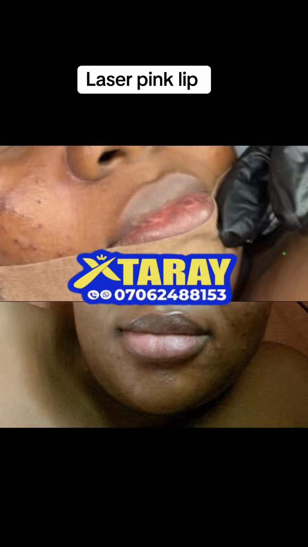 @XTA RAY