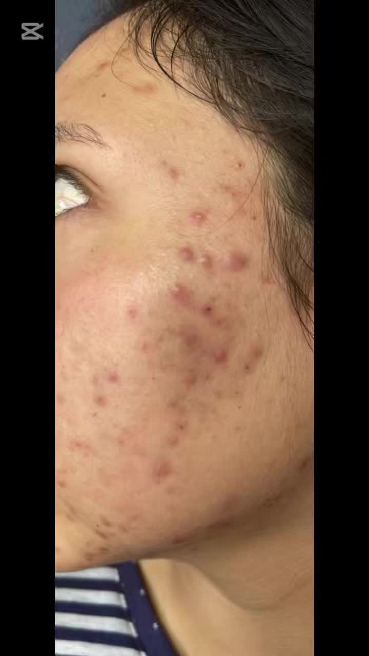 @Dra&ensp;Silvia&ensp;Lorena&ensp;FLORES&ensp;derma
