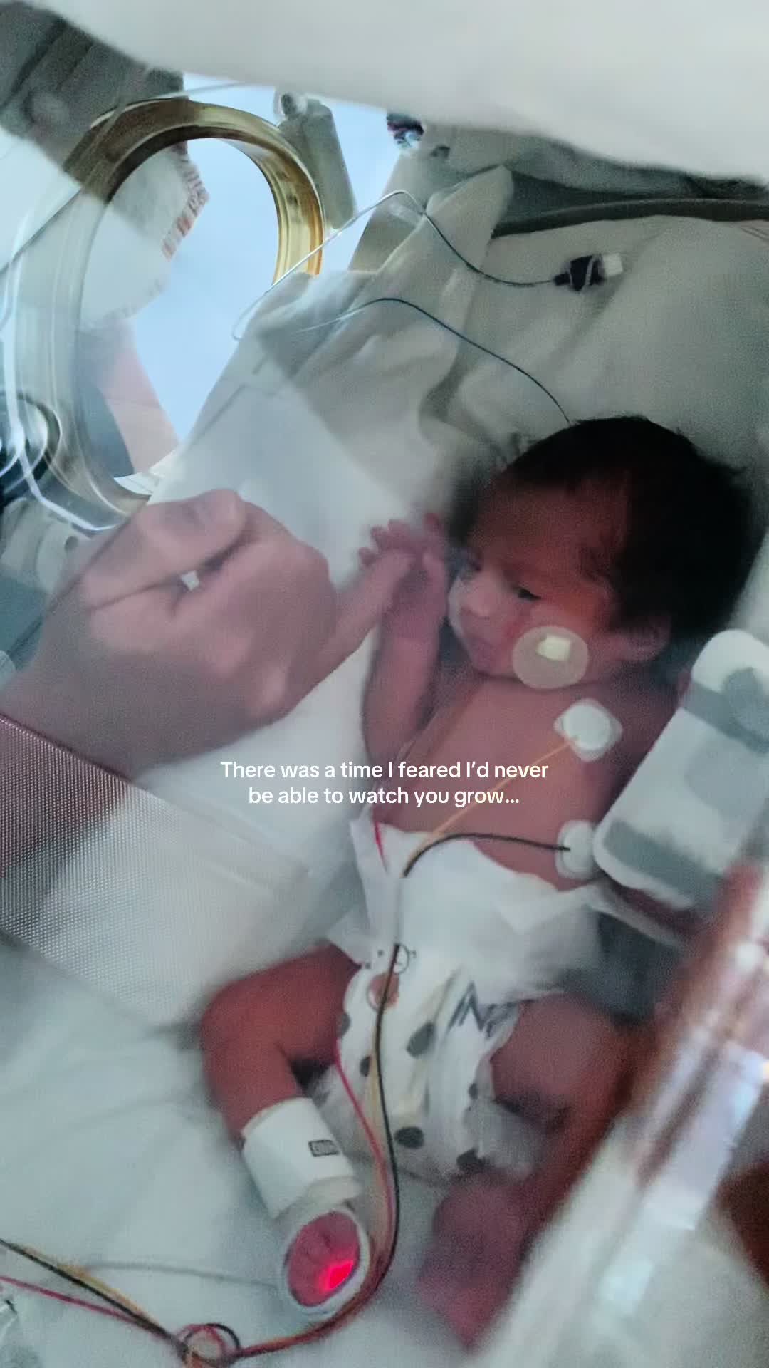 @zoeandherpreemies