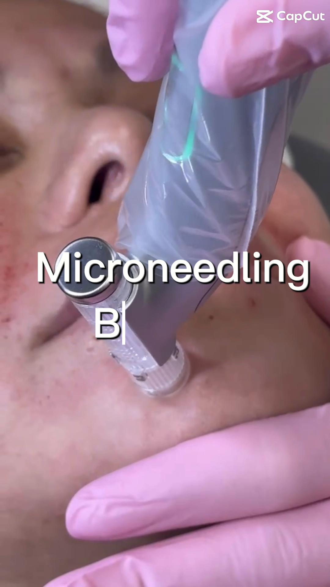 @Rosedermnyc
