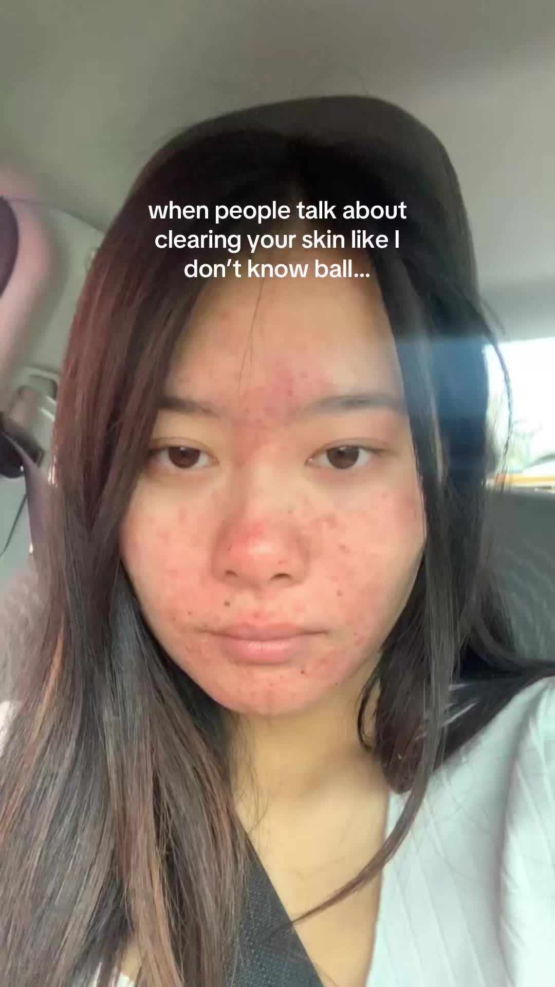 @Cha