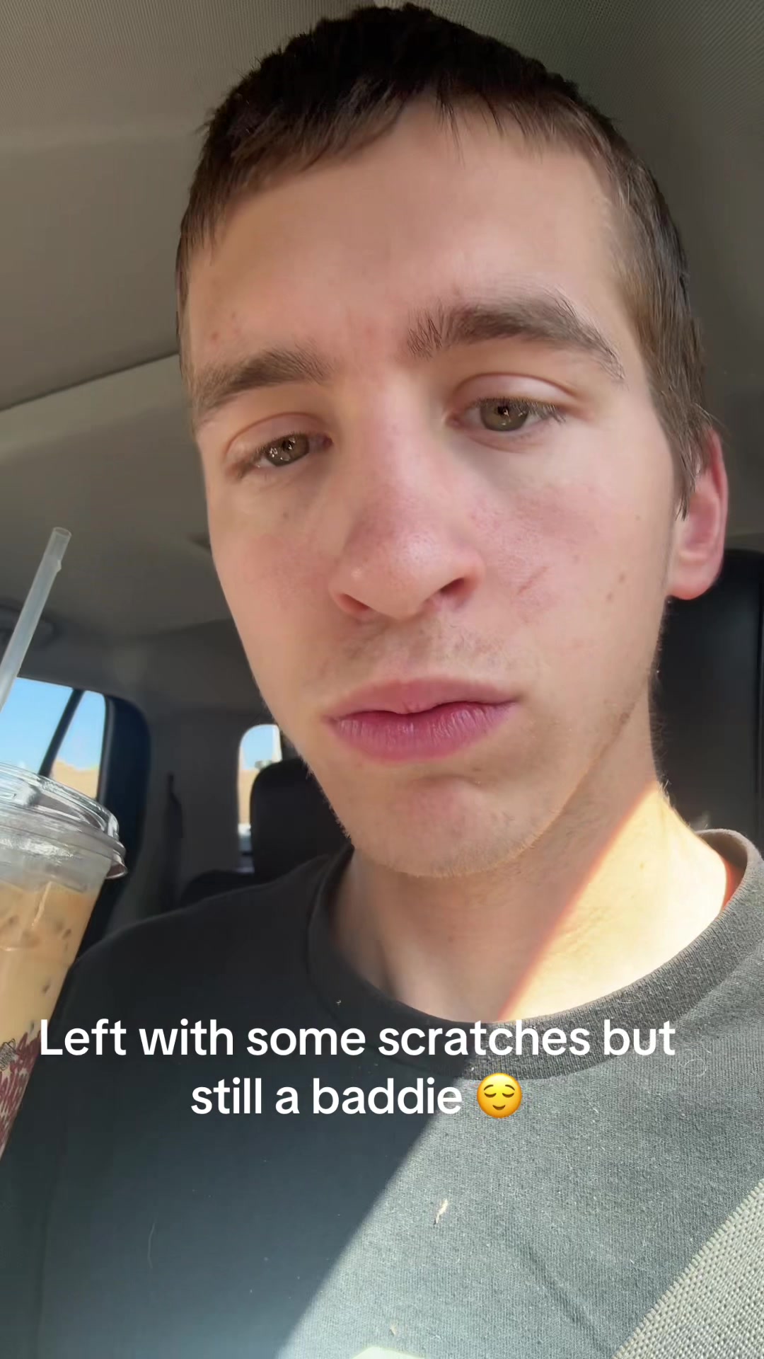 @J