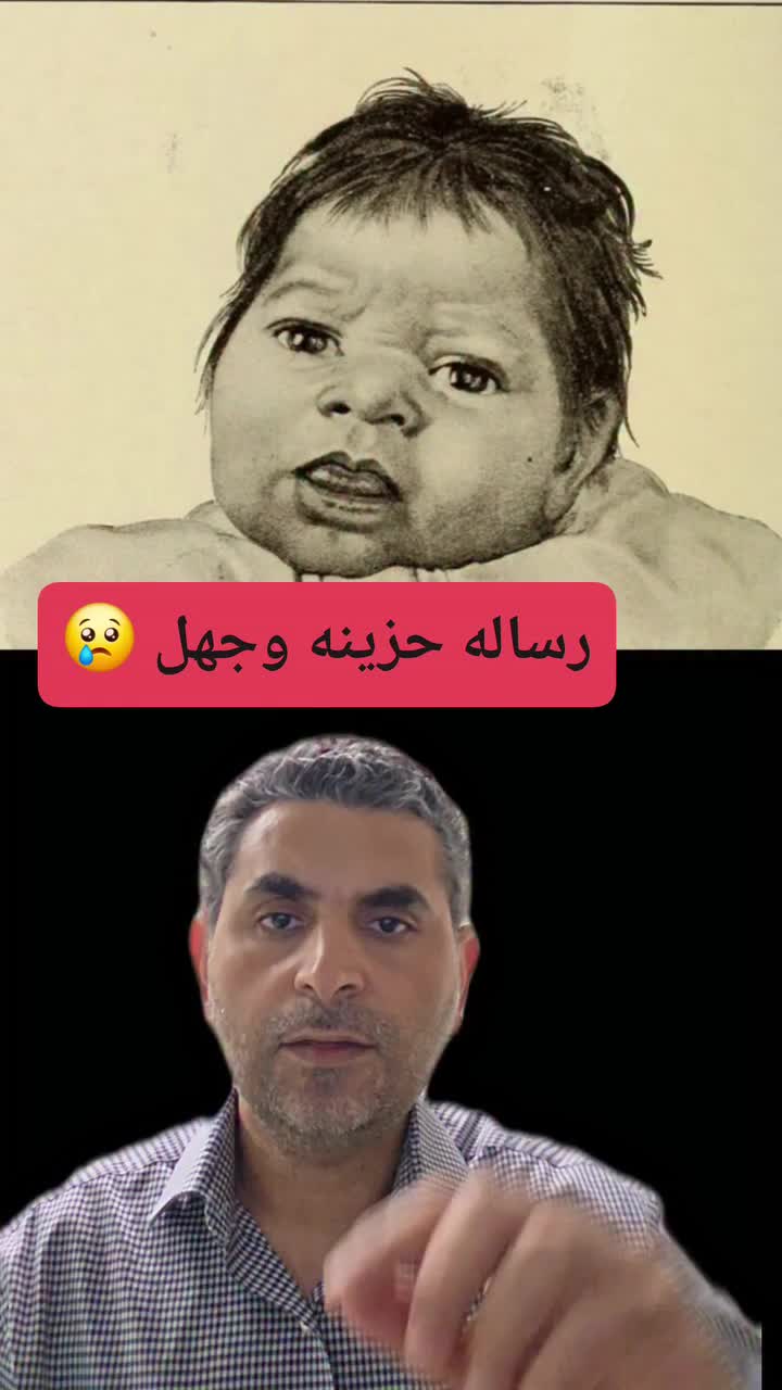 @Dr. Waleed Attia