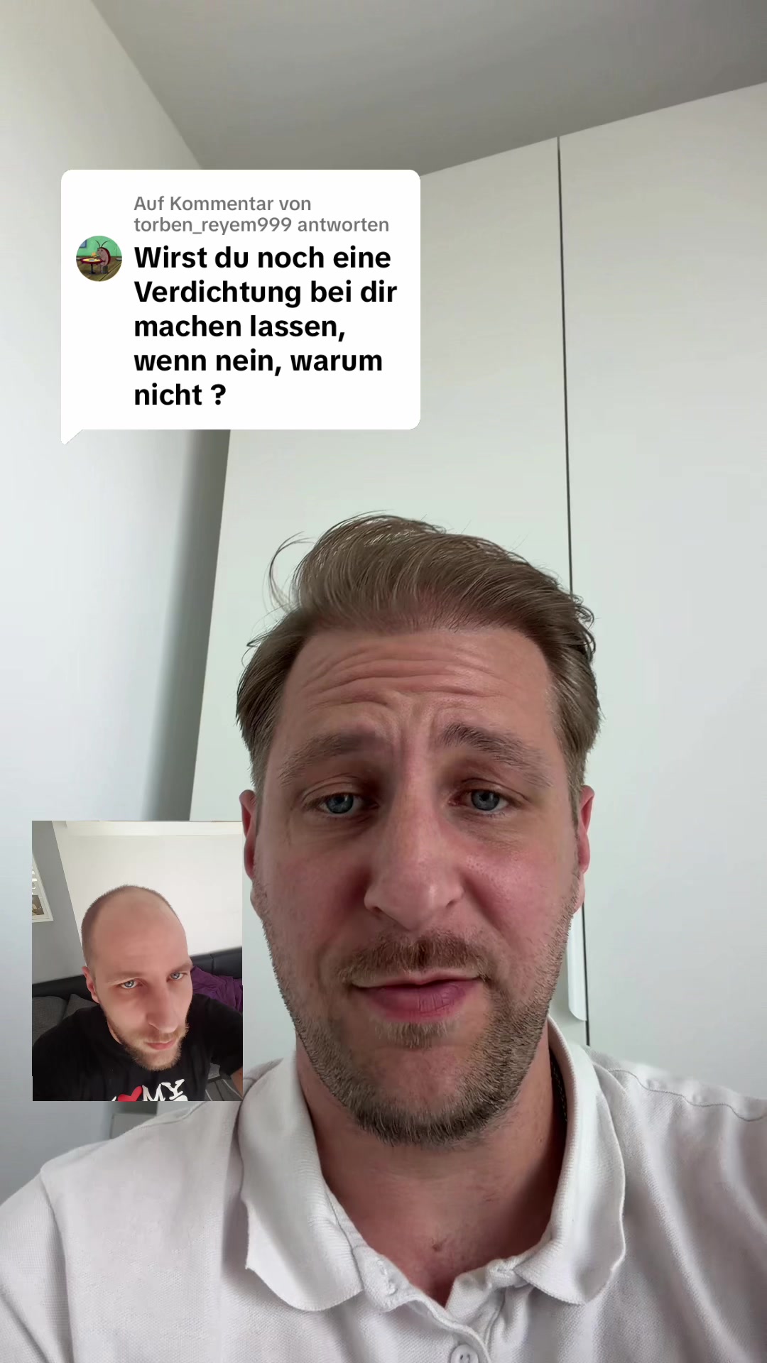 @Mr. Hairtransplant