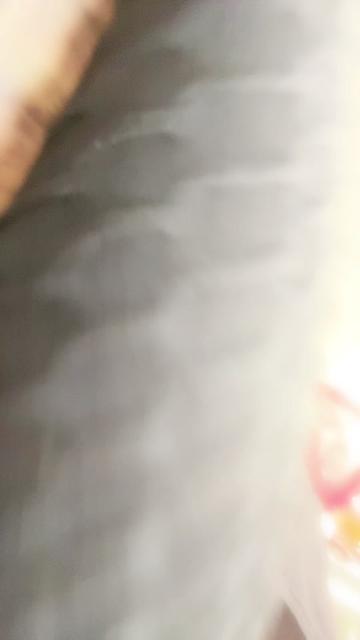 @๐ฏ๐๐๐๐’๐ ๐ฏ๐๐๐๐๐๐๐