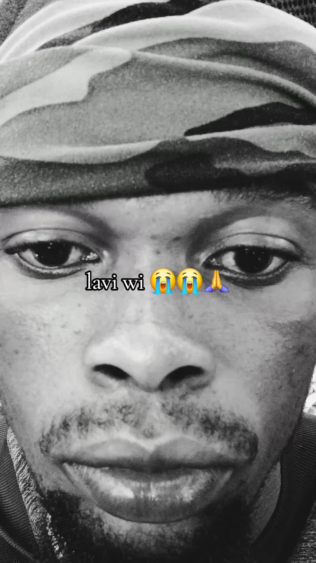 @FÒW REVEYE POU LAZA BACK UP🎌