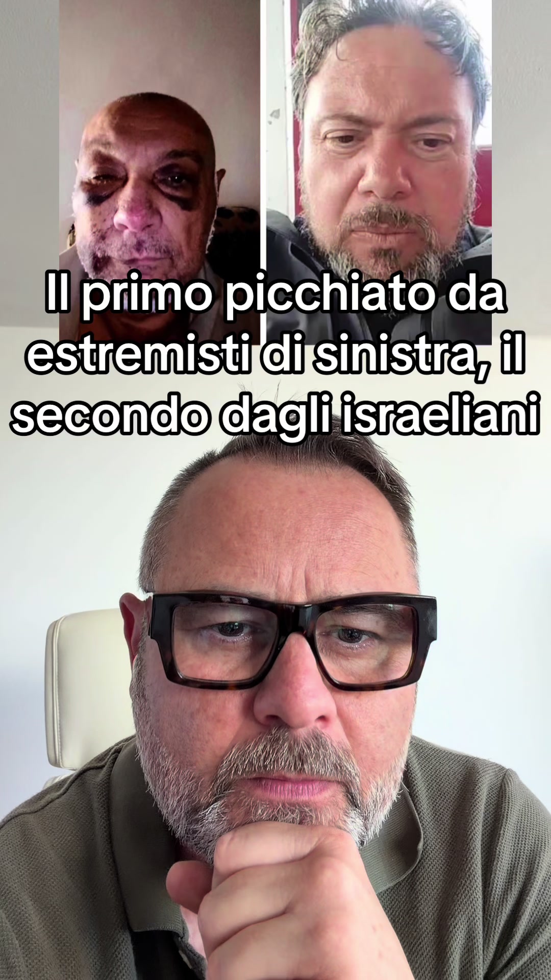@Antonio Dimichele