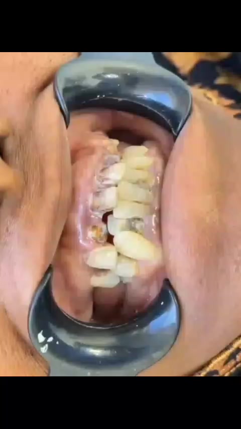 @Family Dental Clinic -Hargeisa
