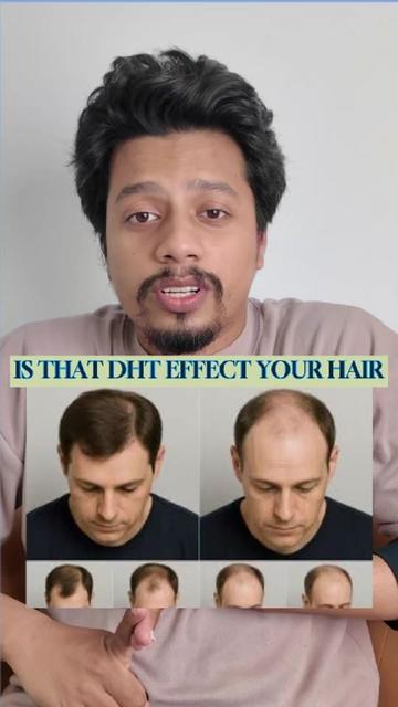 @NAZID HAIR TRANSPLANT