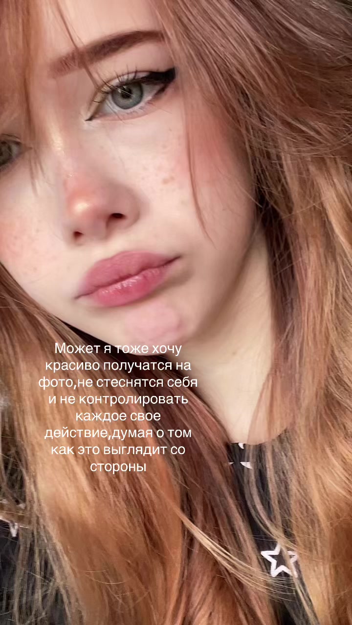 @aL