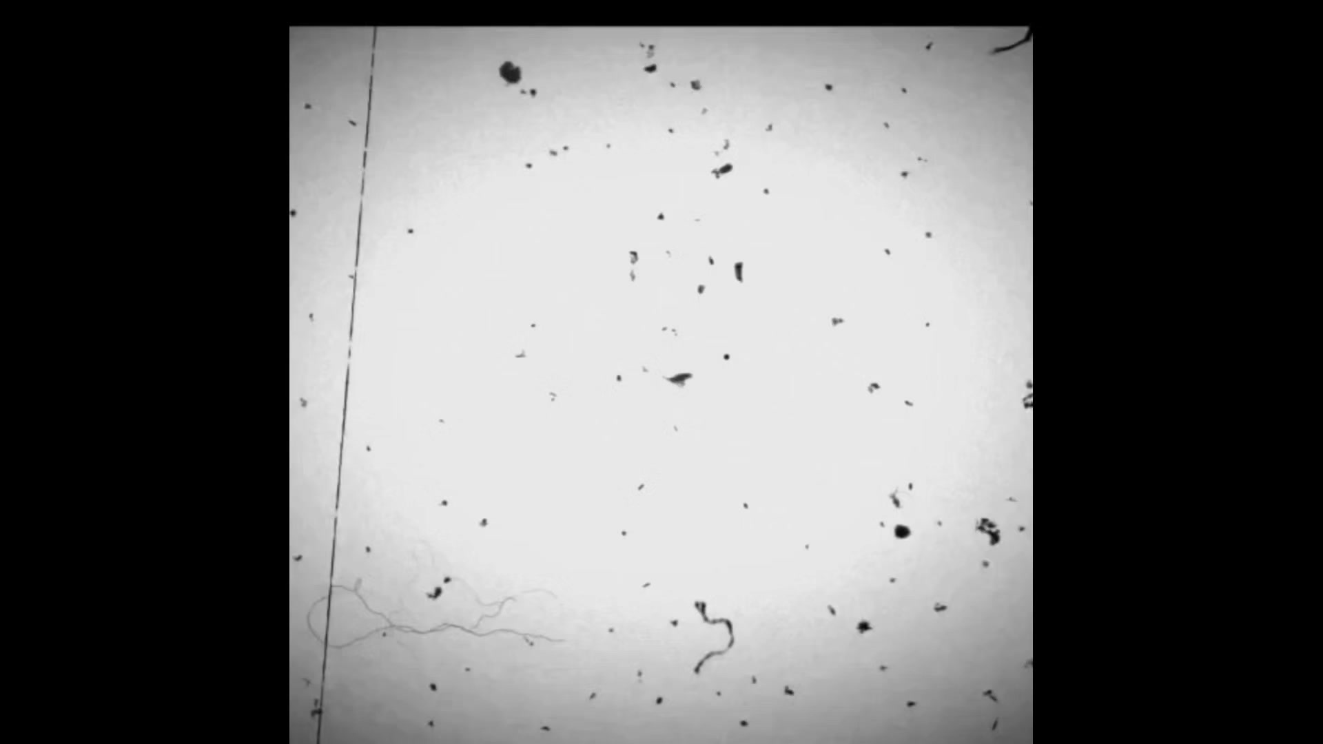 @◌●❤️🩹♨❅BROKEN💔 MǺᏝᎥᏦ ۞꧂
