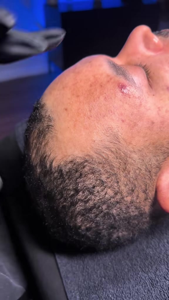 @Philly facials for men