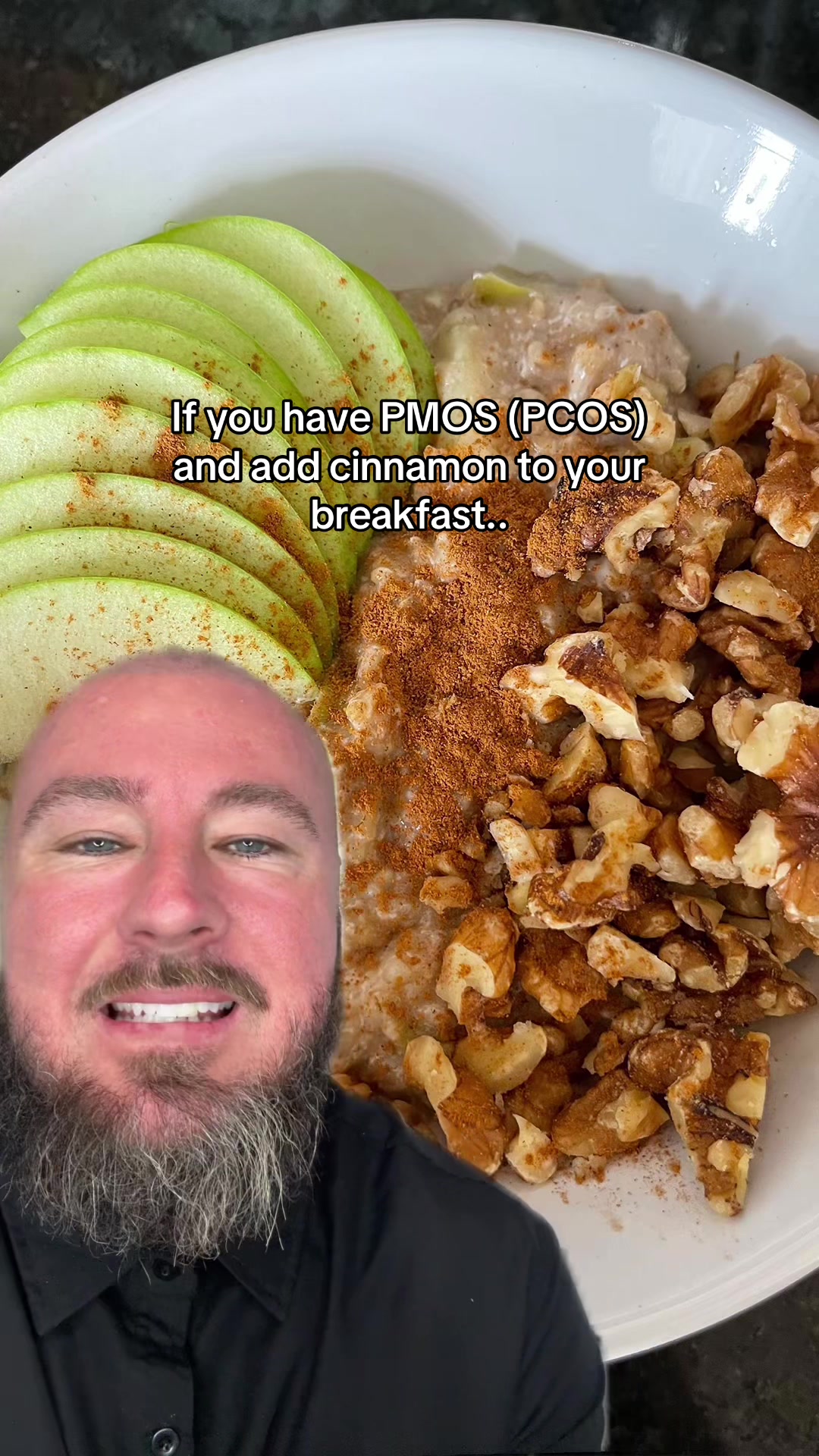 @Drew&ensp;Baird&ensp;|&ensp;the&ensp;PCOS&ensp;mentor