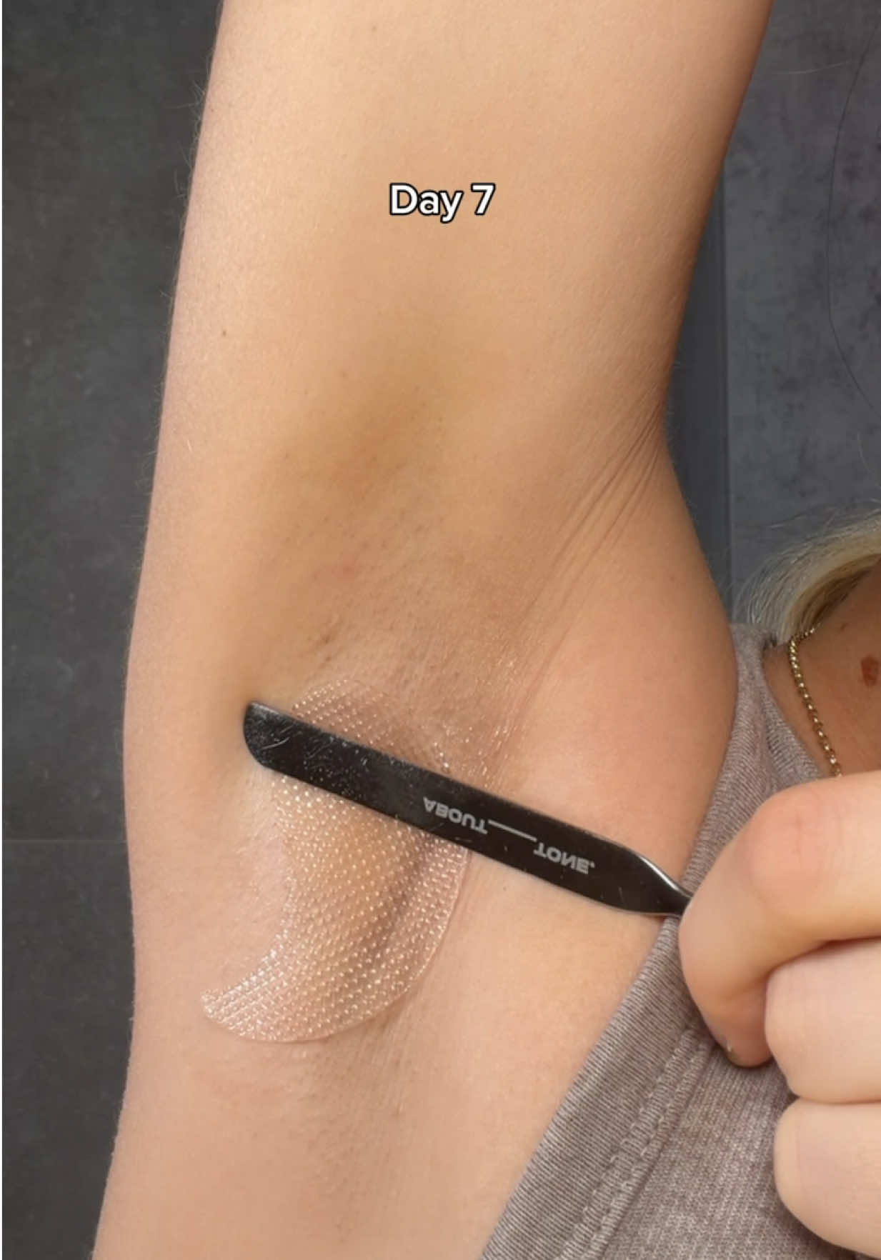 @Loresa