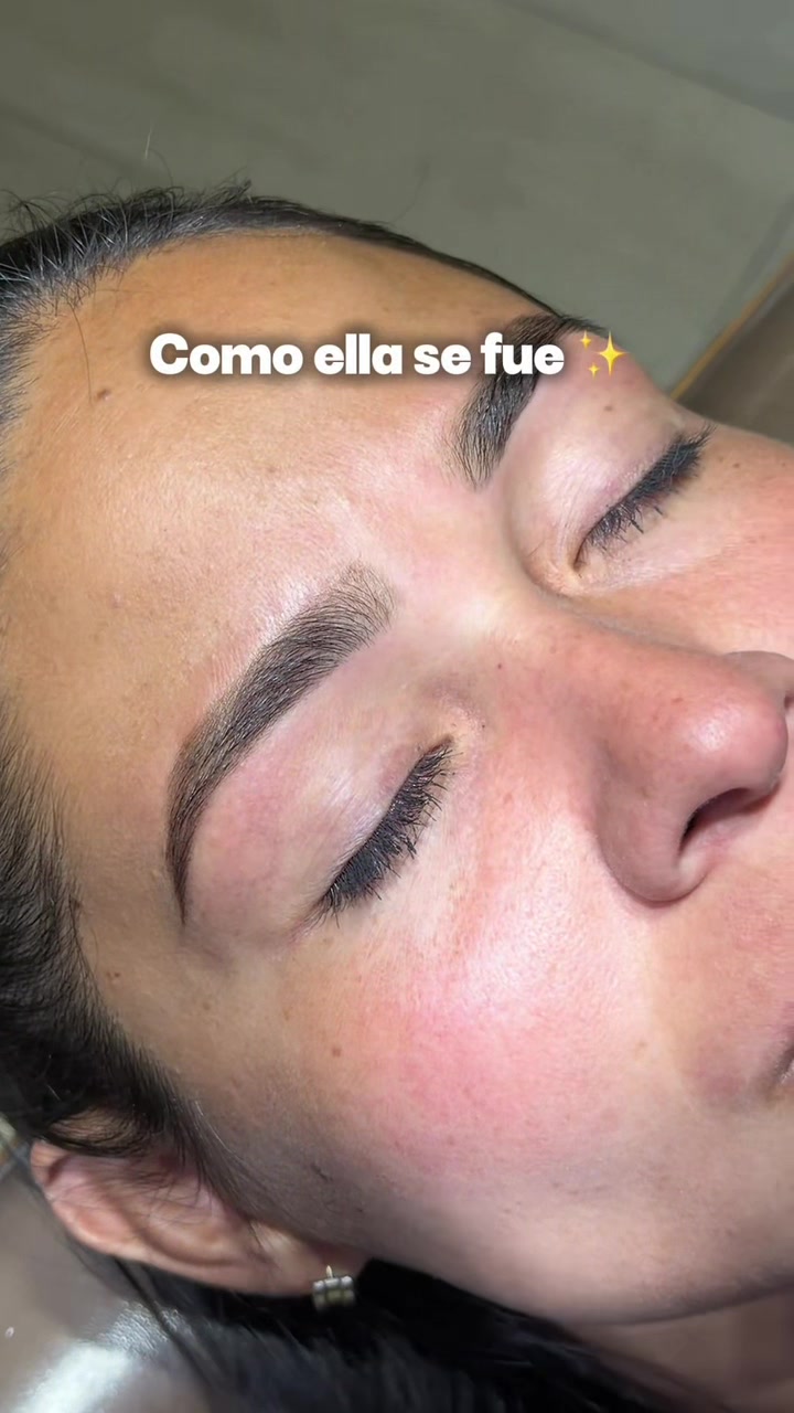 @CherryBomb
