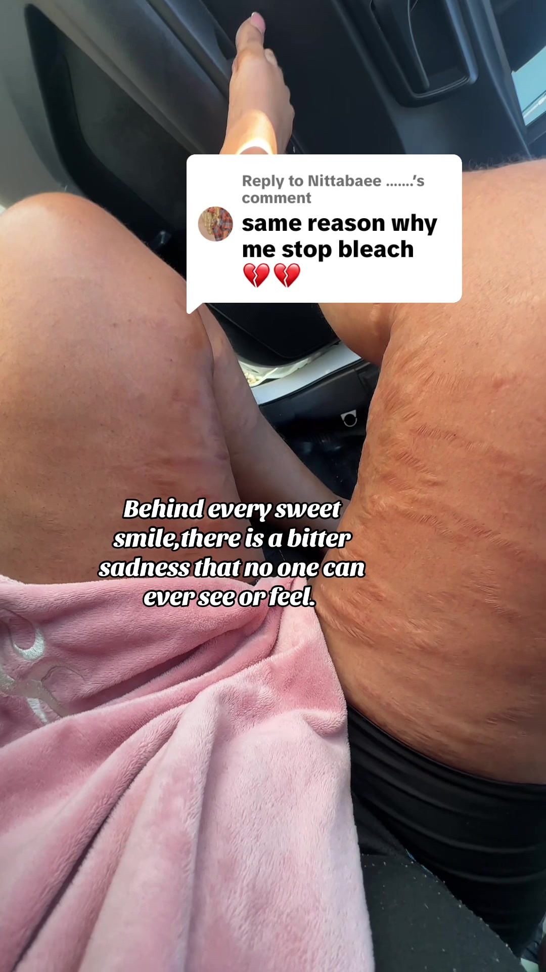 @Stretch_markeraser