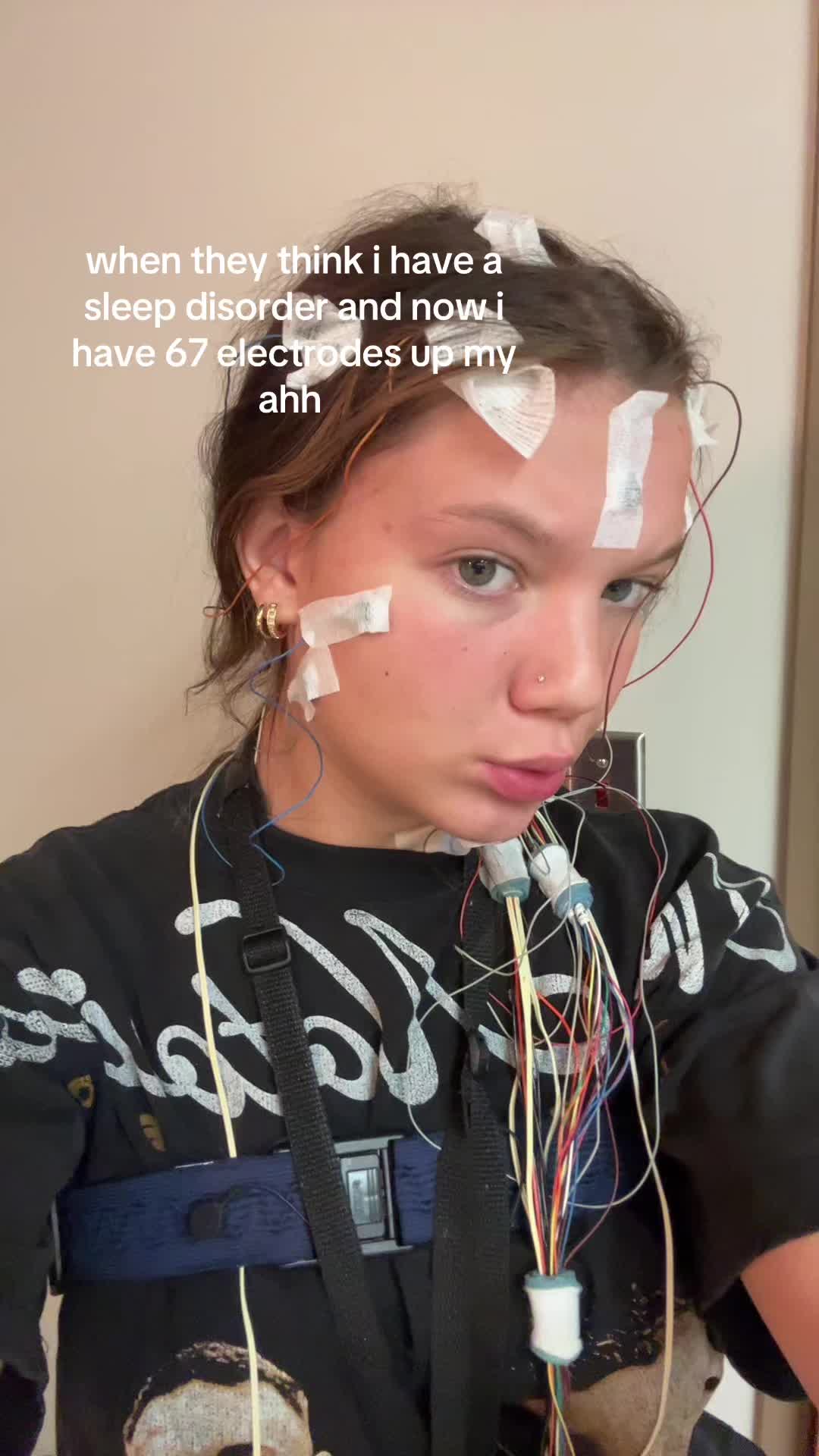 @mal