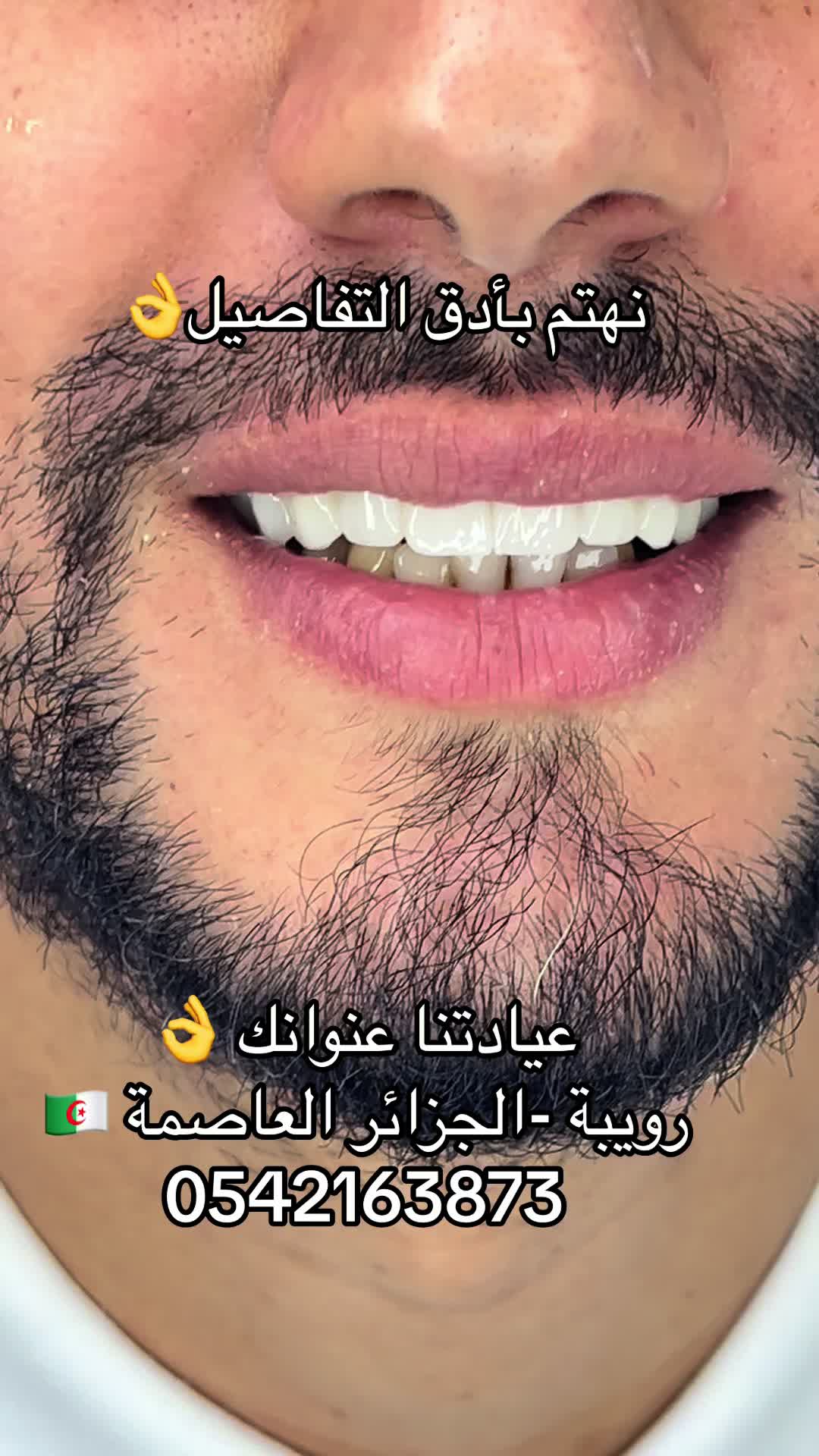 @GOSMILE ROUIBA🇩🇿