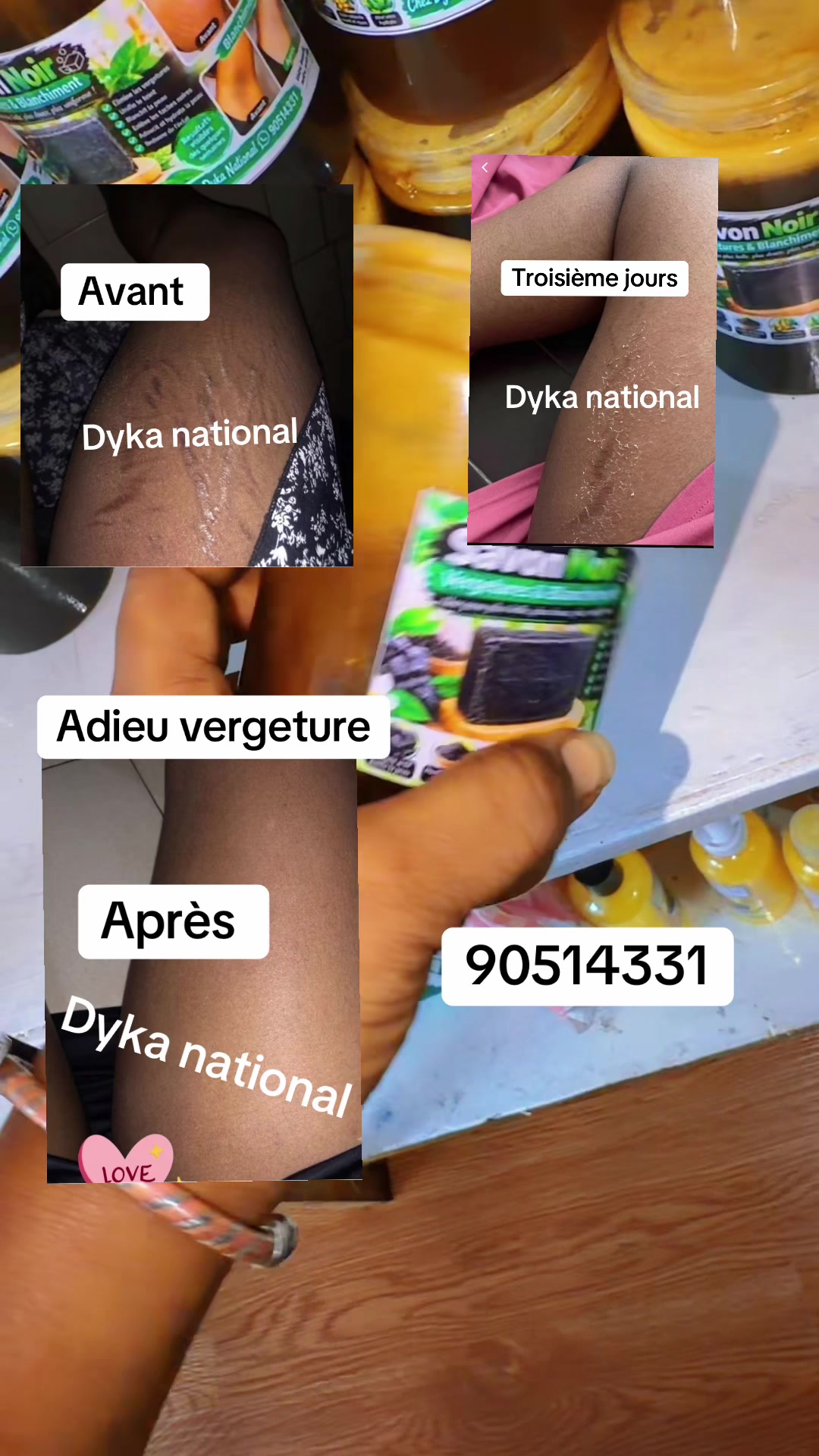 @Rondeurs By 🍑Dyka National 🤝