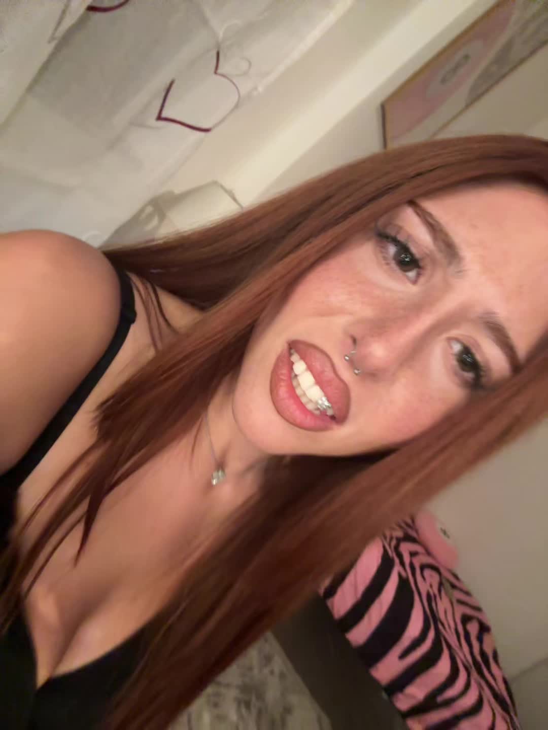 @ketoprophede