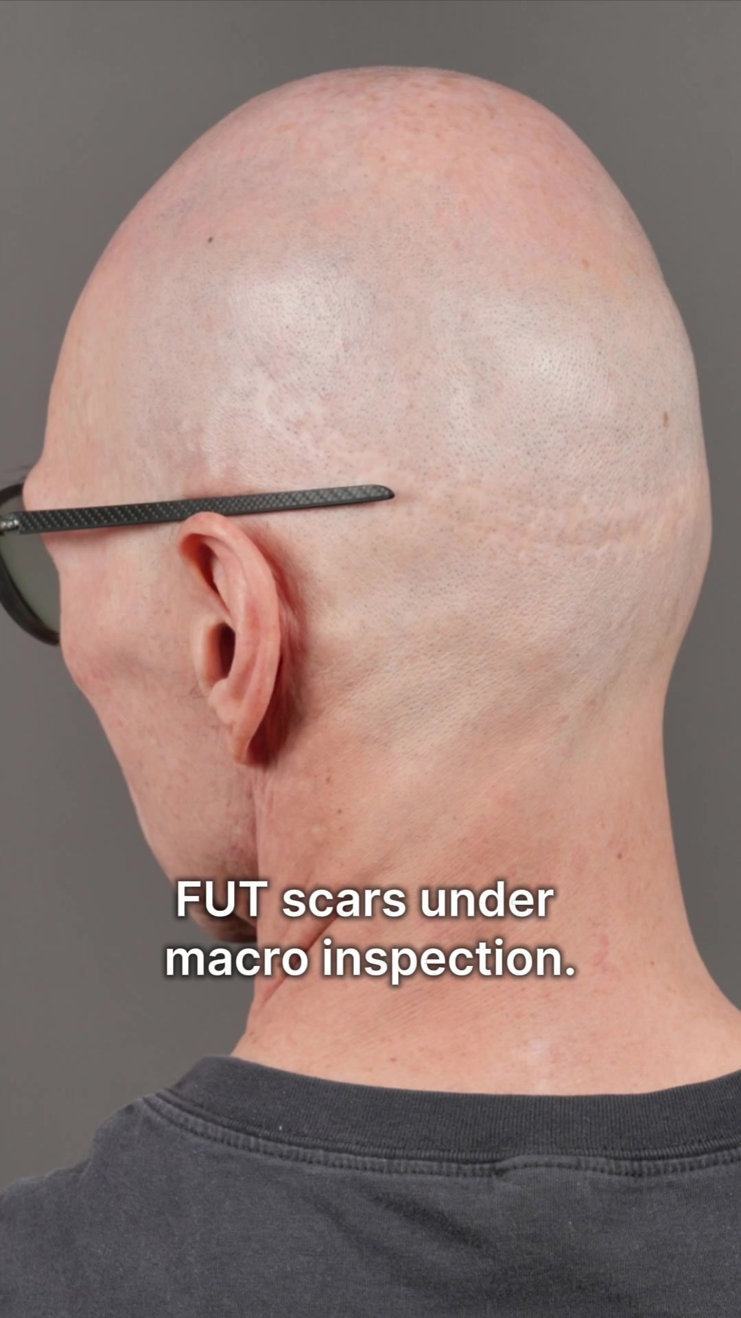 @Enhanced Scalp