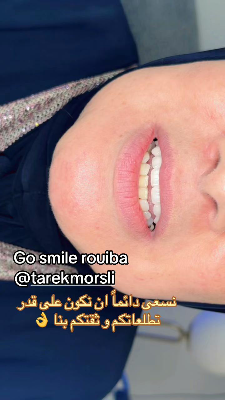 @GOSMILE ROUIBA🇩🇿