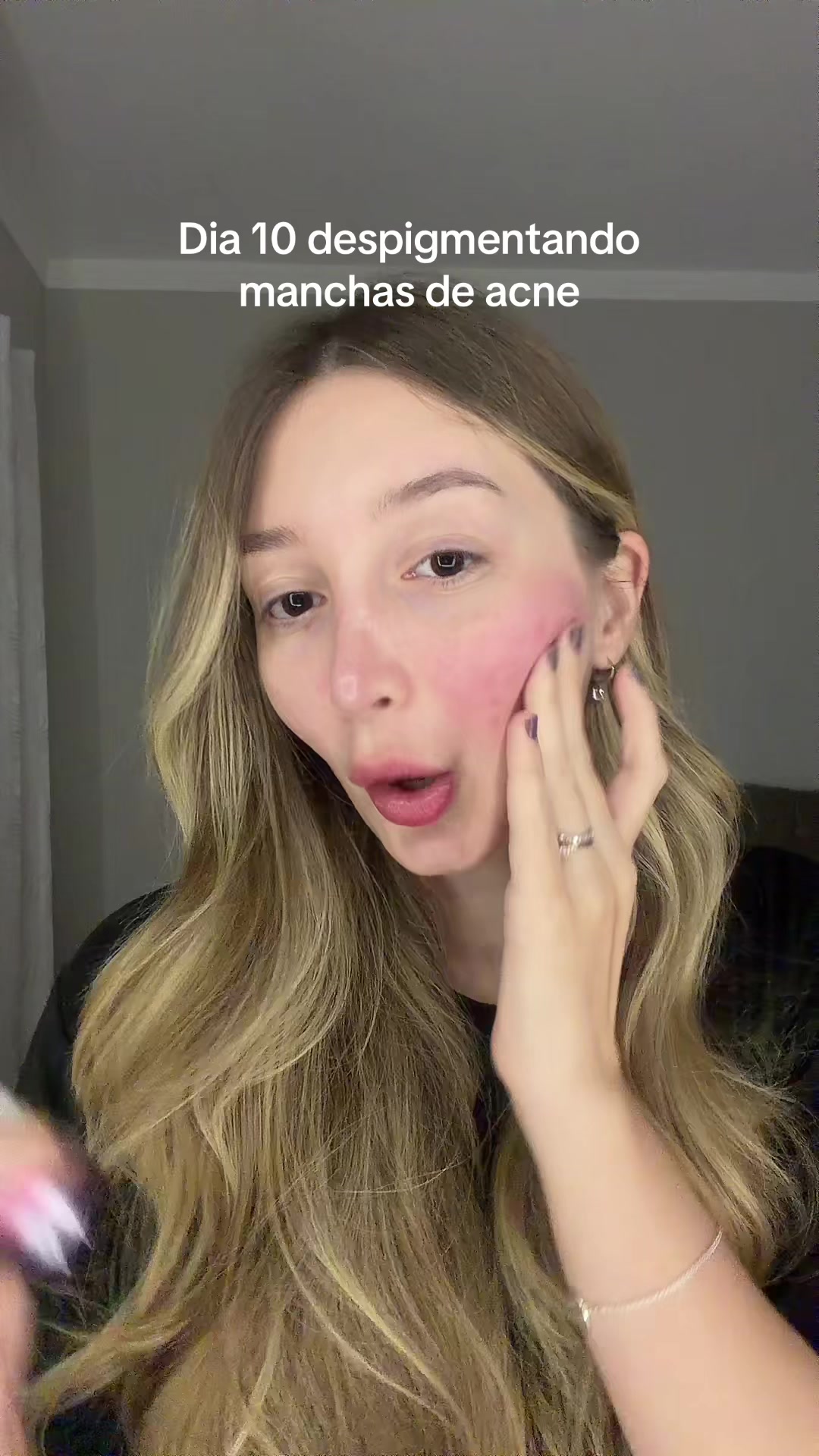 @Karol Mendes
