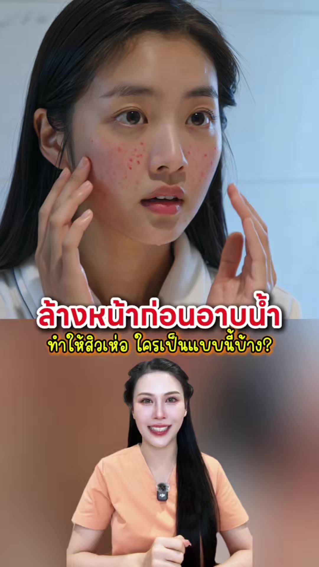 @พยาบาลอัญ