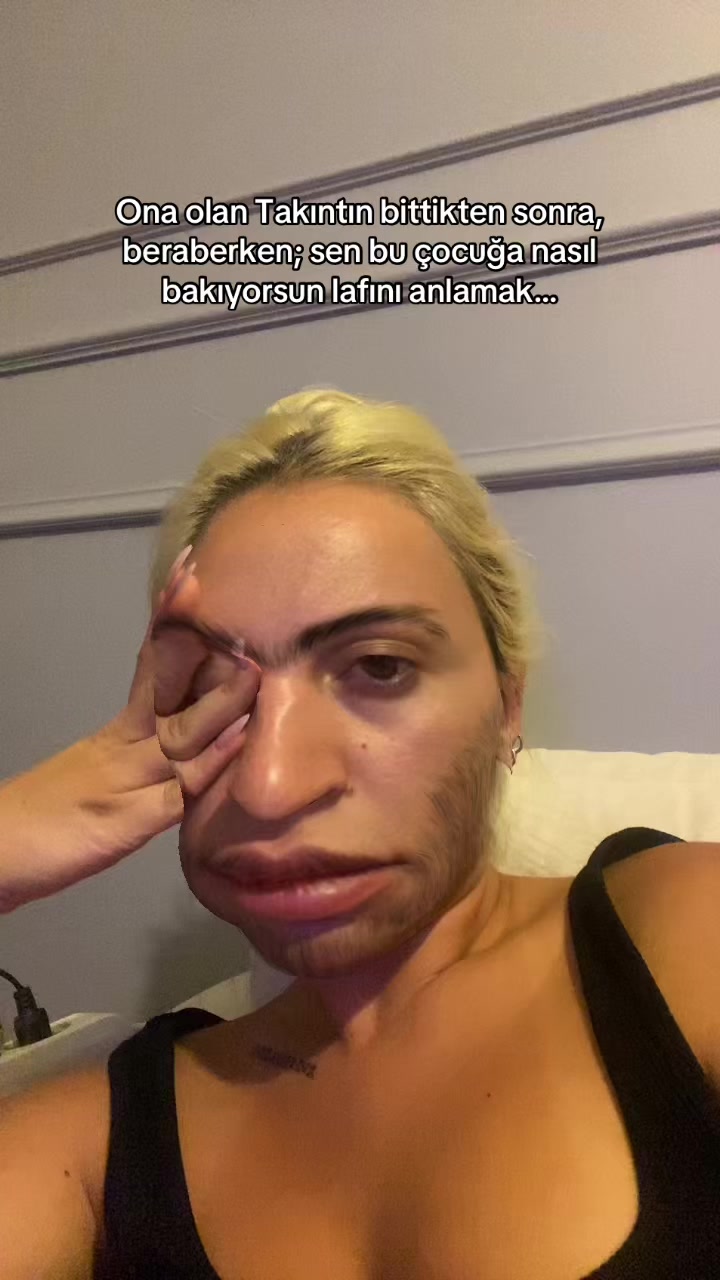 @Beyza Akmeşe