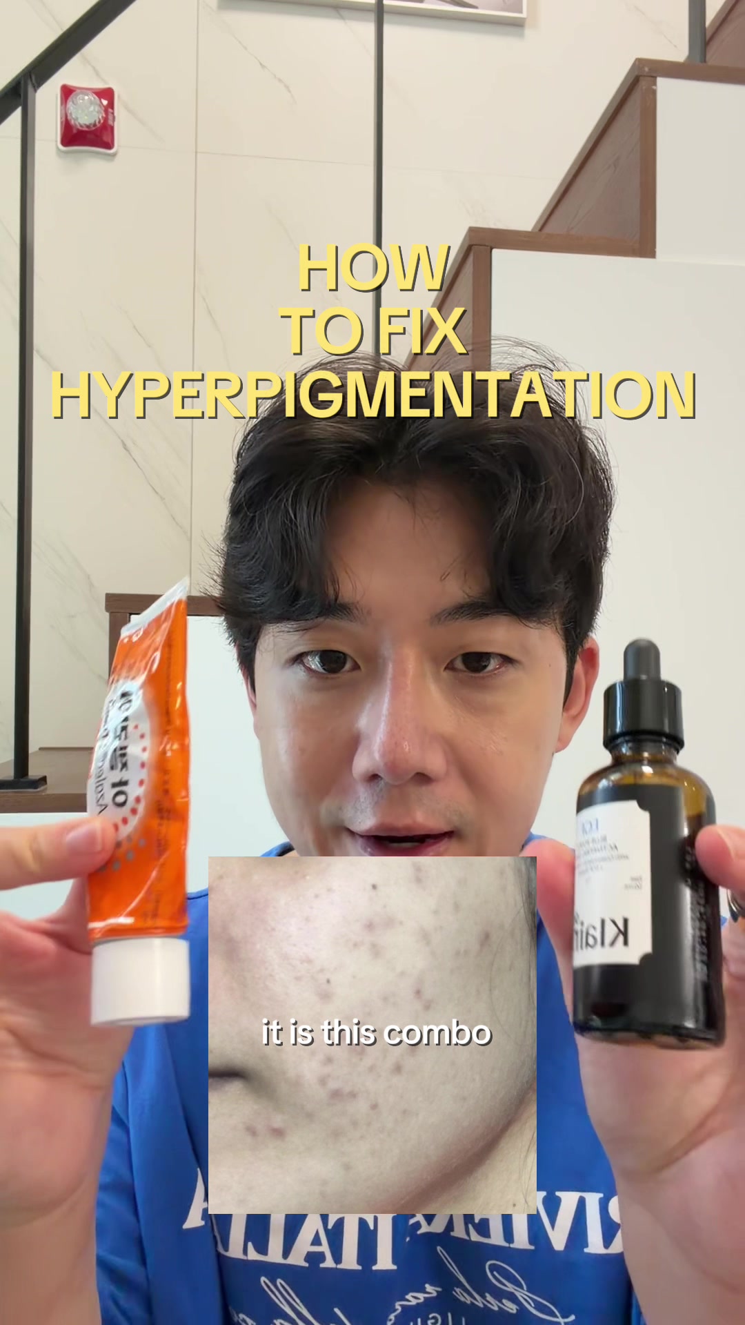 @Brute Choi 🧿