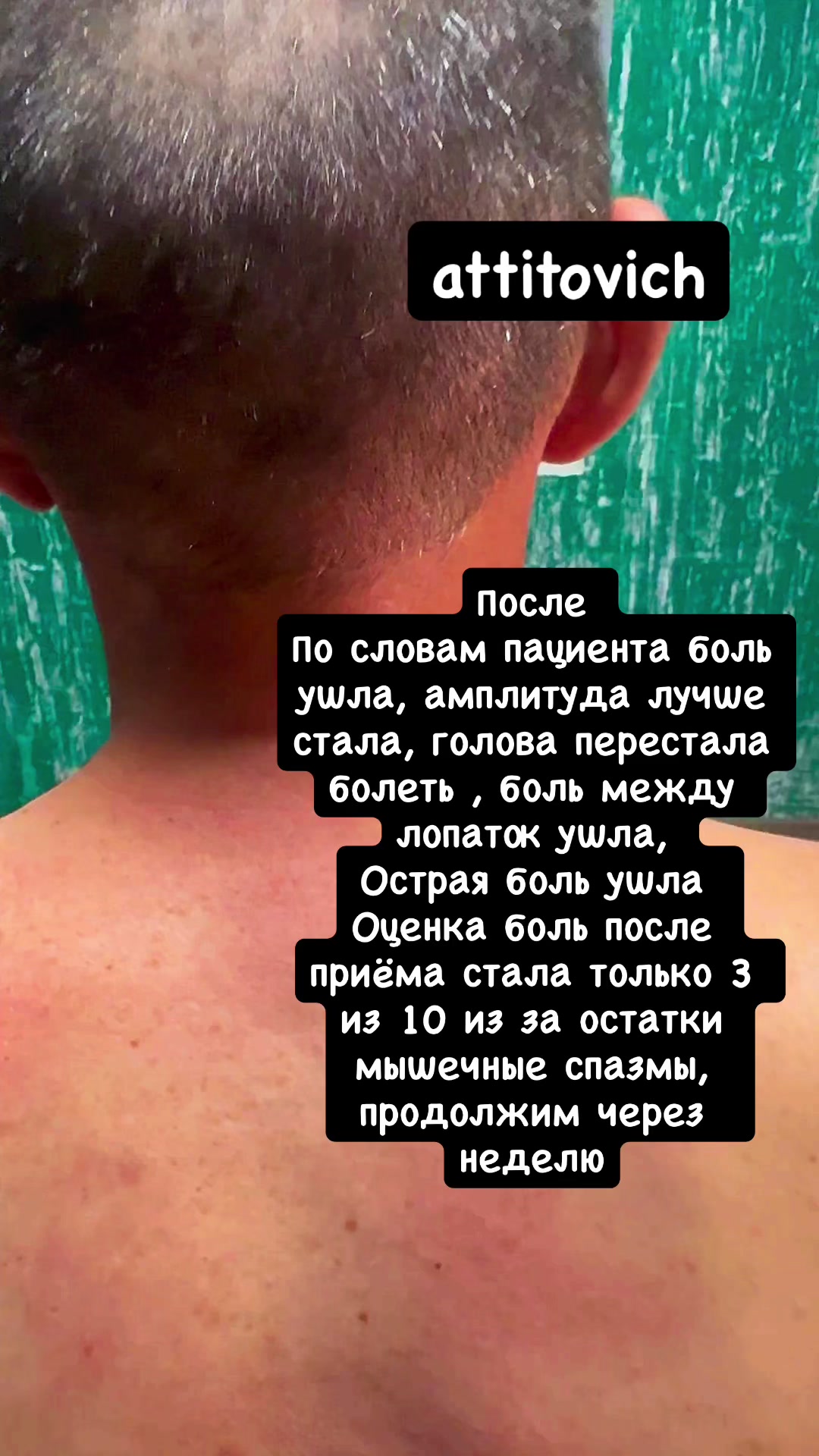 @Attitovich russia ๐น๐ท๐ช๐ฌ