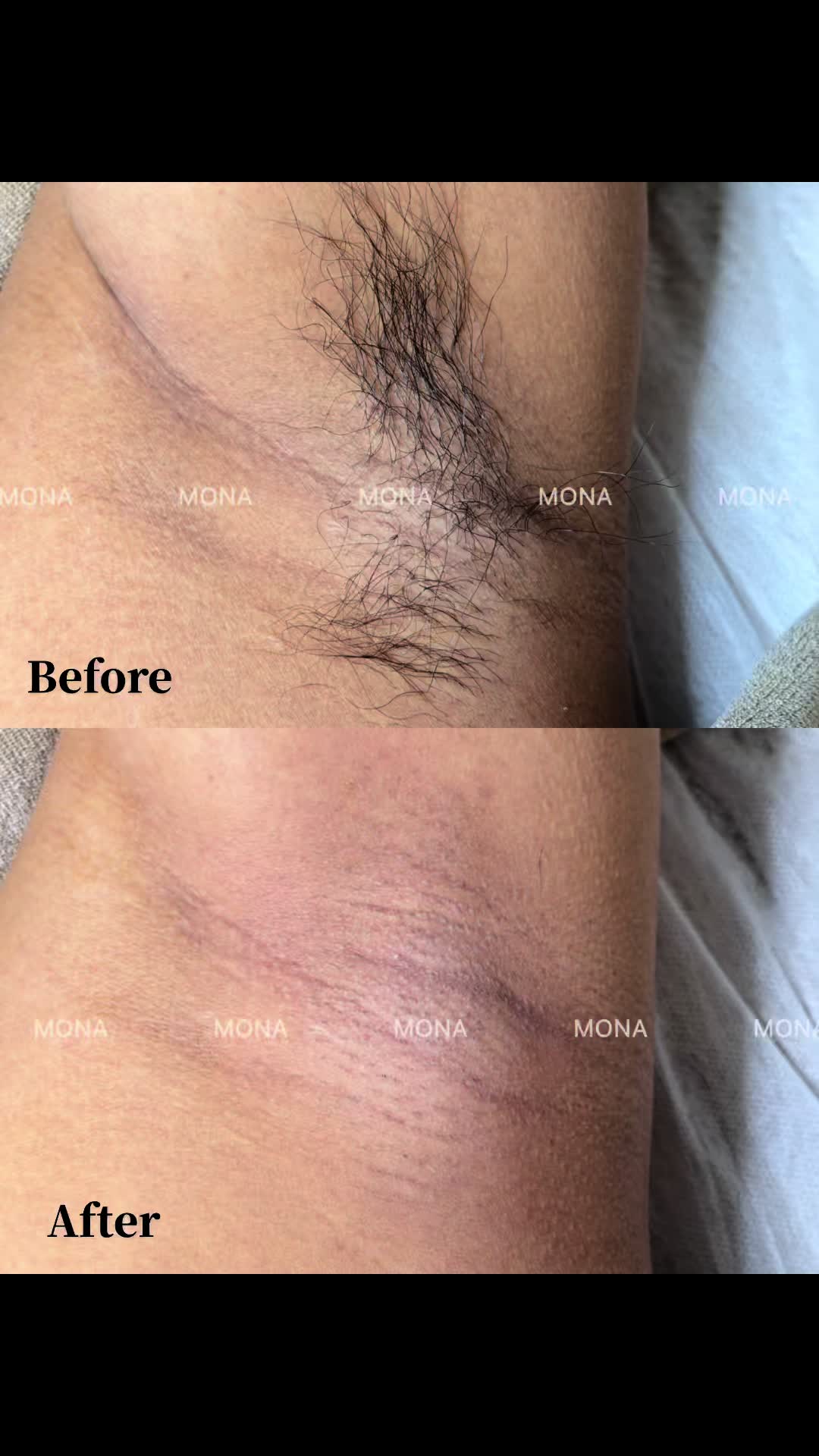@MONA SKIN LASER & BEAUTY