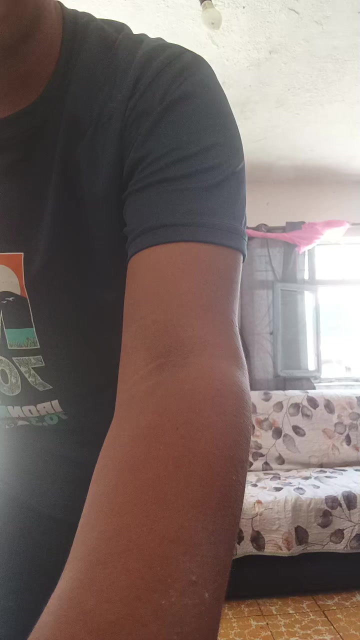 @Bernardina Magdaleno