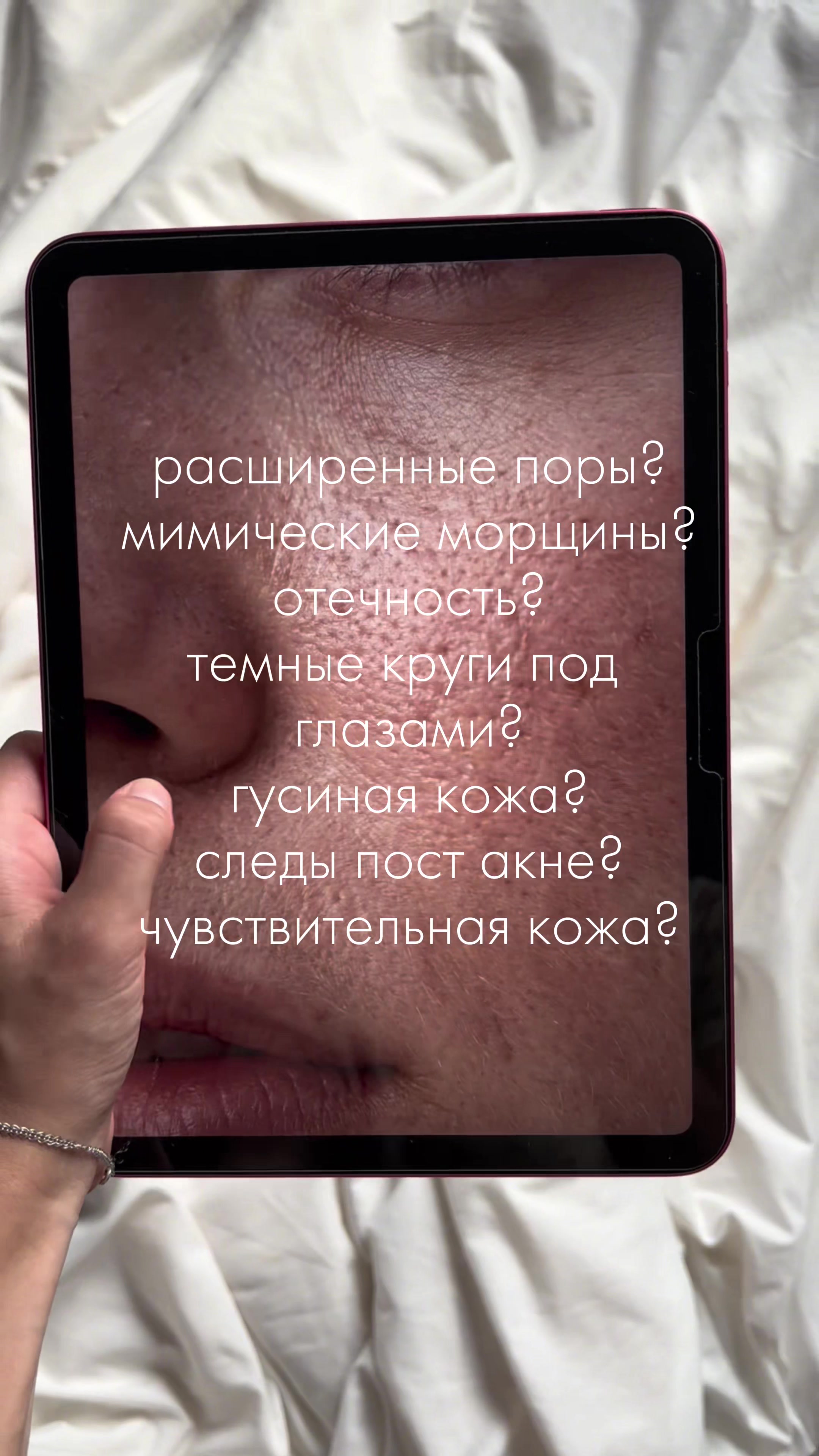 @дэмати