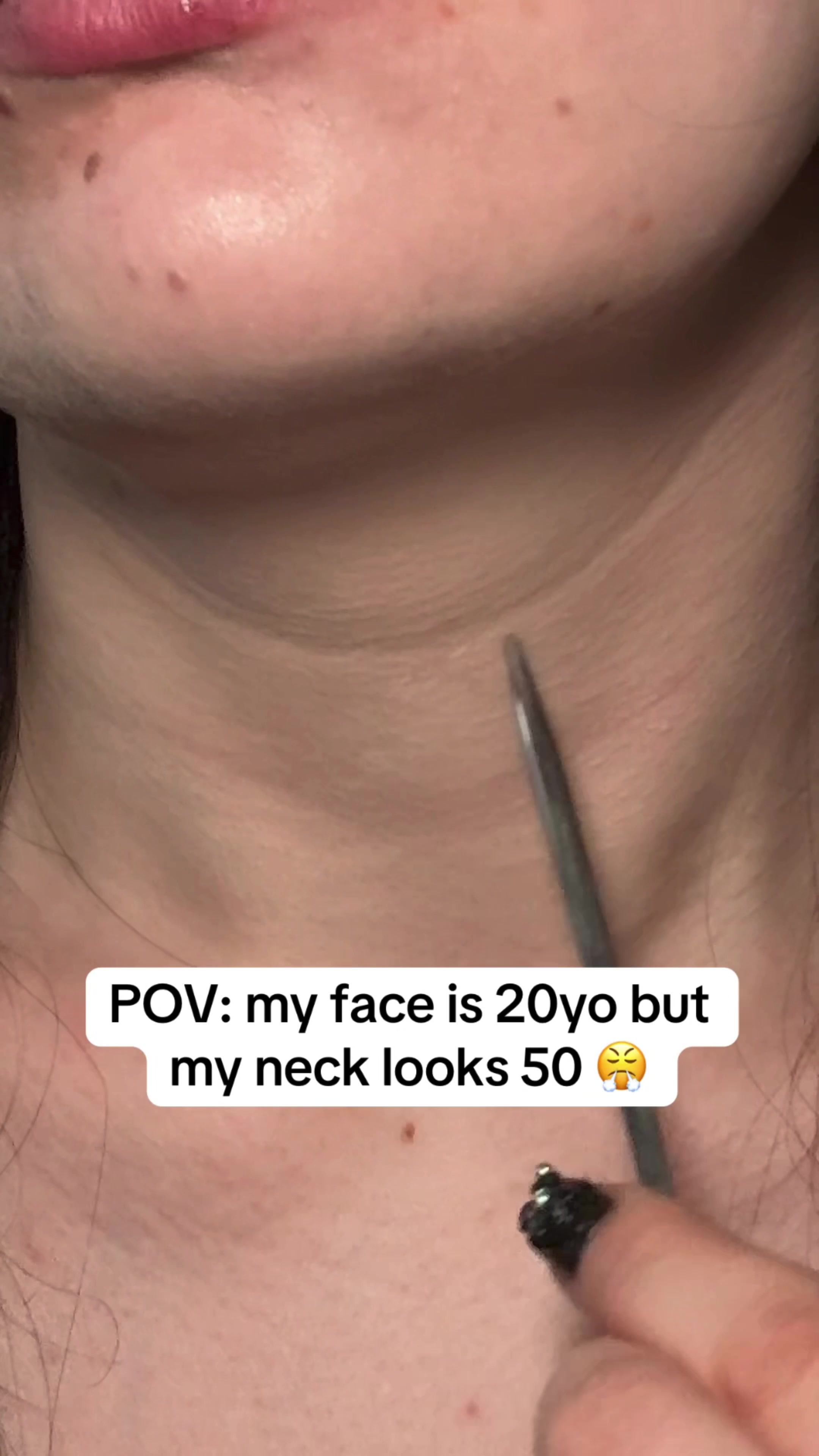 @watermelonsugarskin