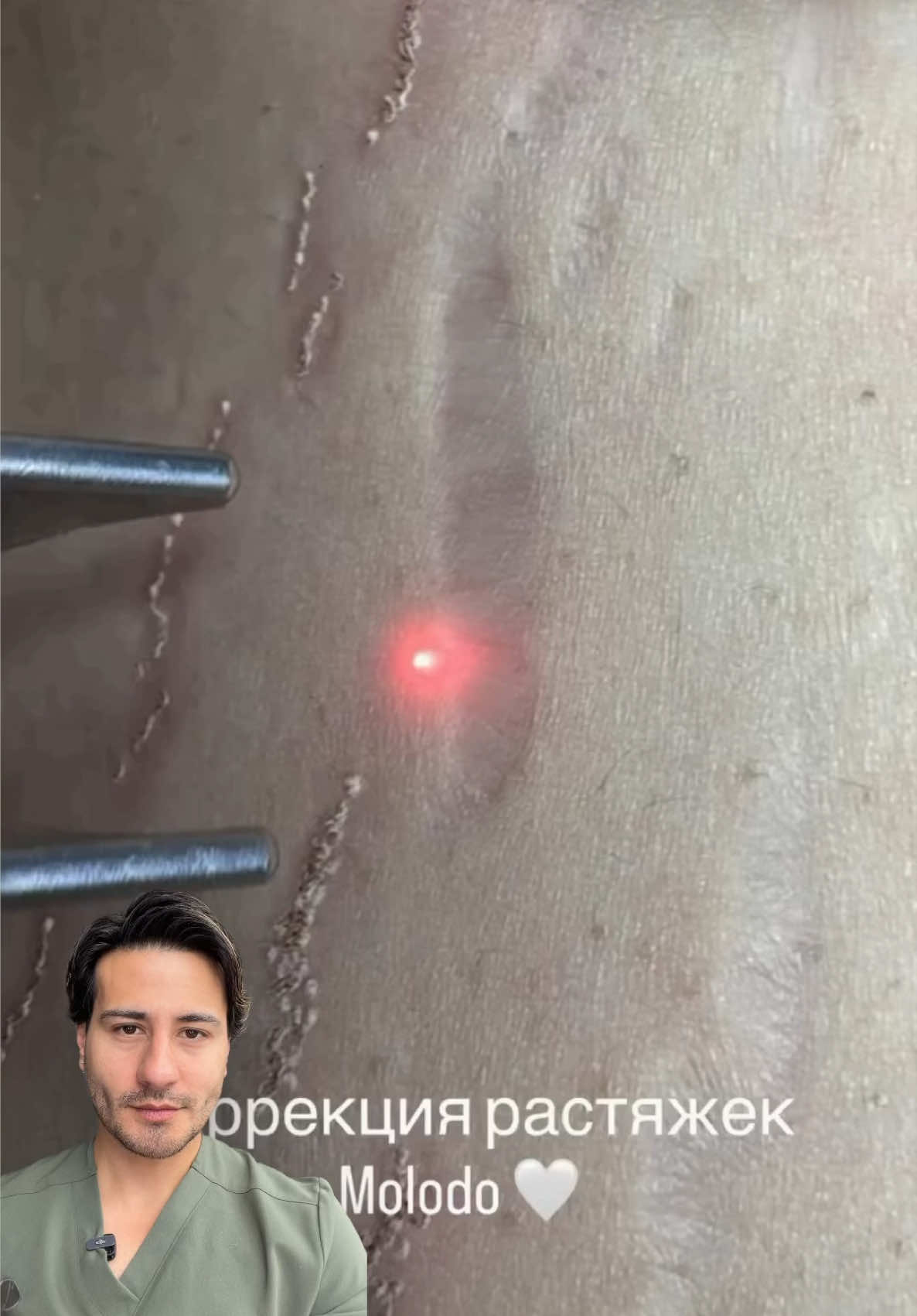 @chrisantiage