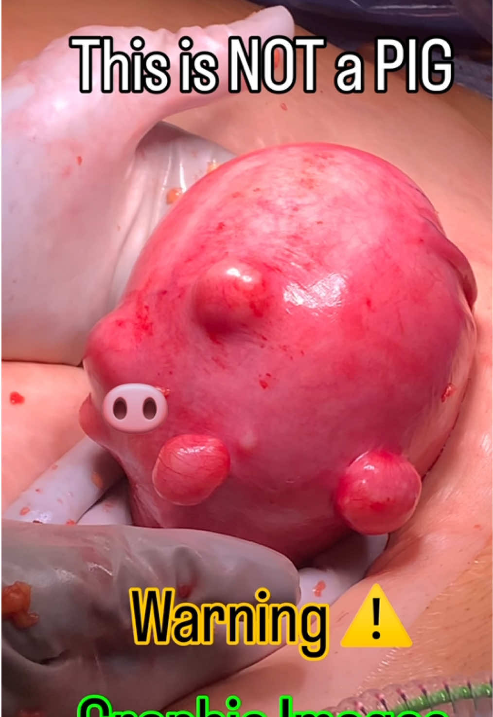 @drrakheepatel