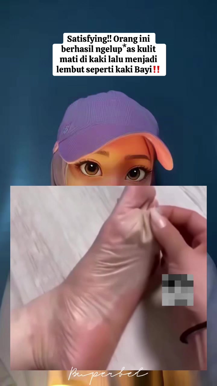 @B U P E R