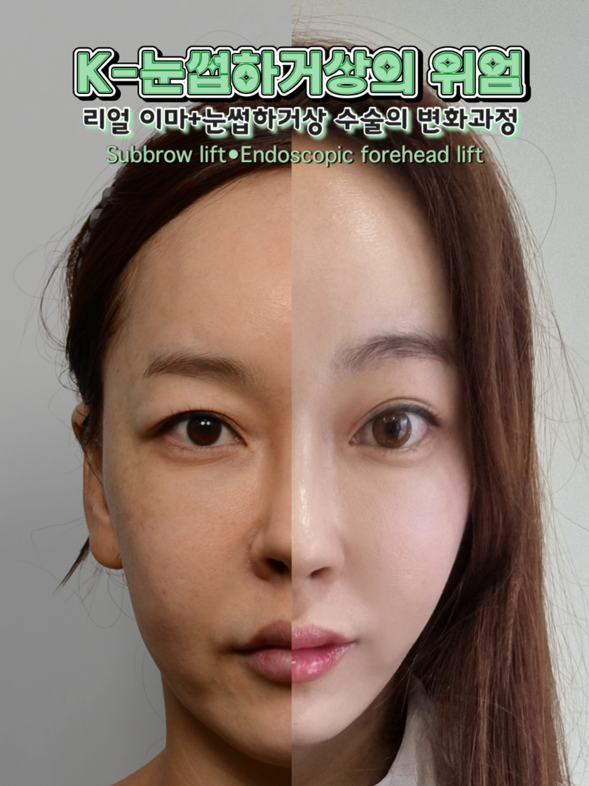 @리프성형외과