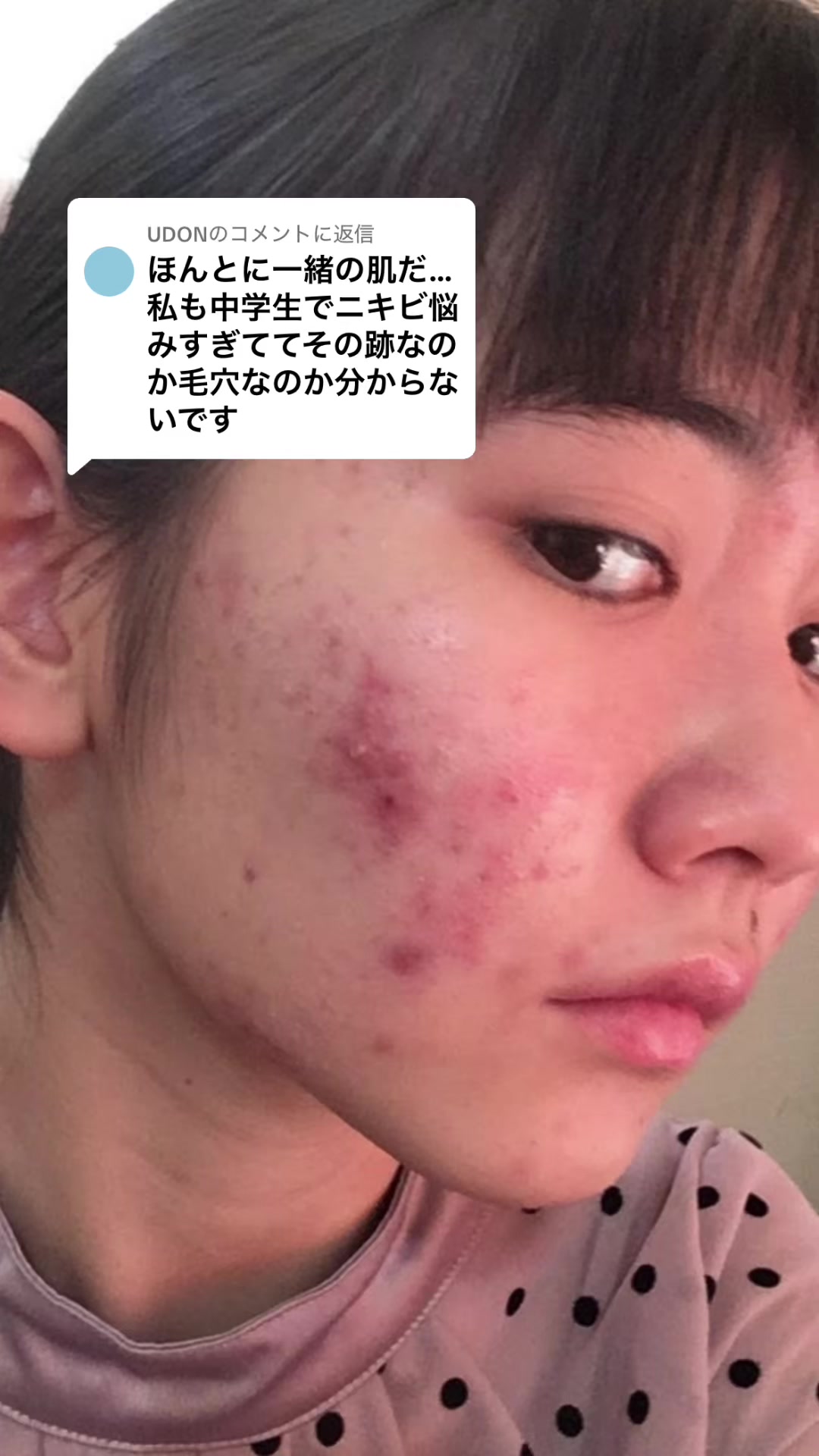 @ぼん
