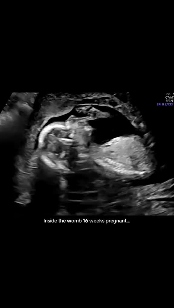 @zoeandherpreemies