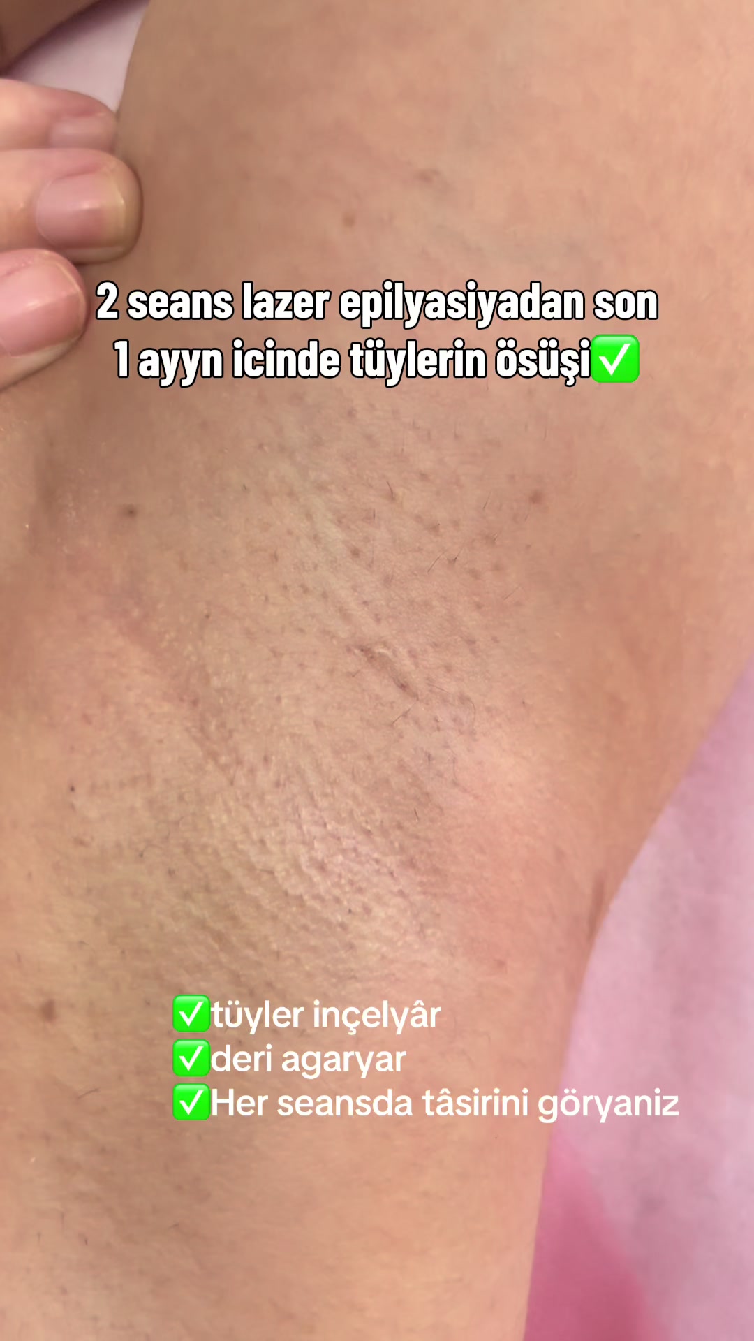 @guljana_laser_beautysalon