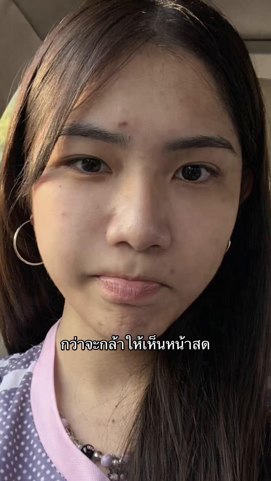 @หนูทิ้น